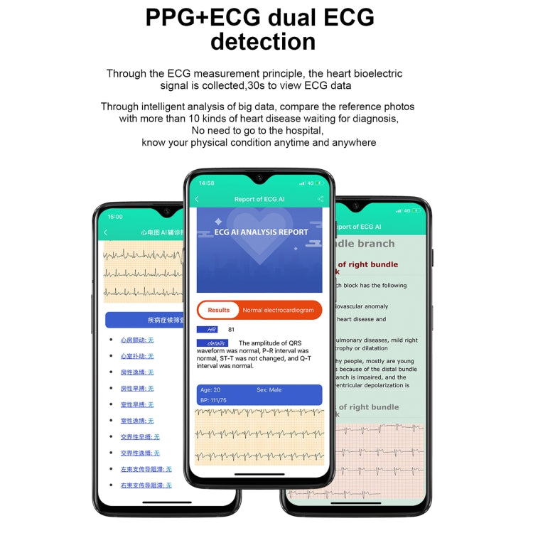 E86 1.7 inch TFT Color Screen IP68 Waterproof Smart Watch, Support Blood Oxygen Monitoring / Body Temperature Monitoring / AI Medical Diagnosis, Style: Leather Strap(Black) by bashfashion